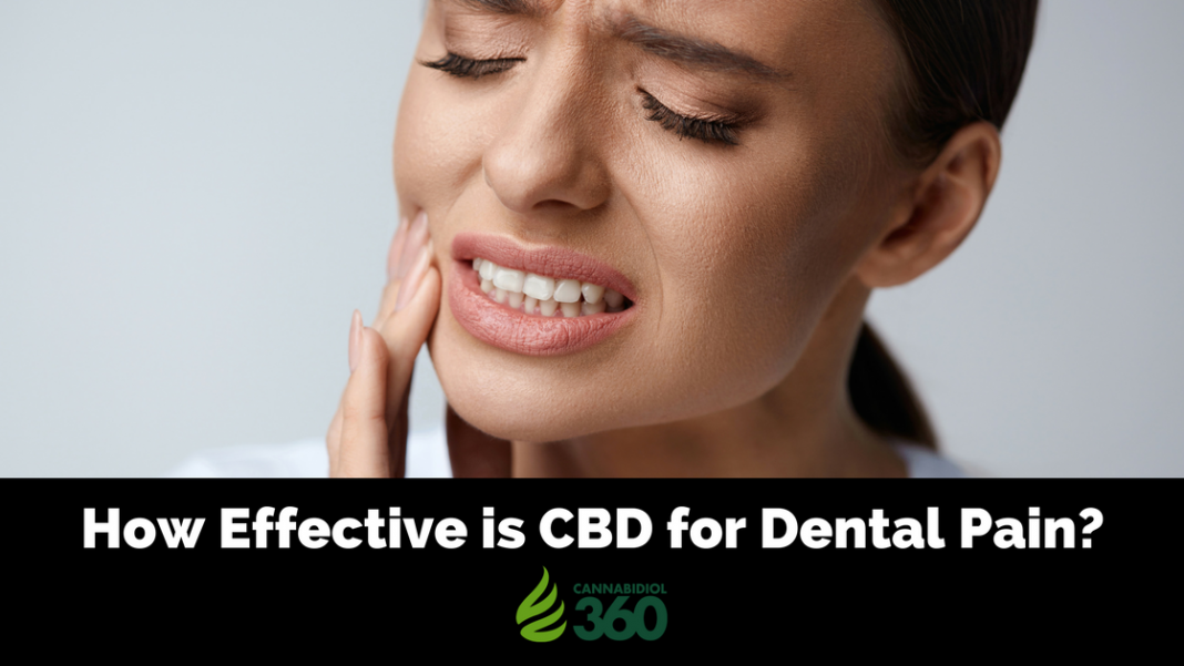 CBD in Dentistry