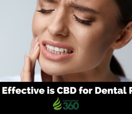 CBD in Dentistry