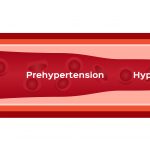 Hypertension graphic