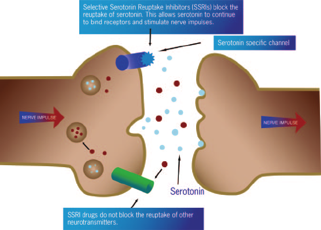 ssri-ocd-treatment-cannabidiol-360