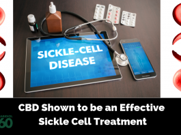 CBD Shown to be an Effective Sickle Cell Treatment