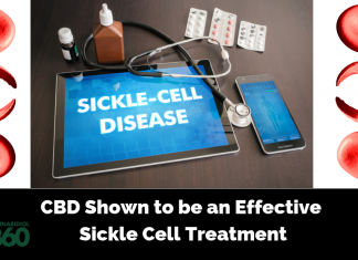 CBD Shown to be an Effective Sickle Cell Treatment