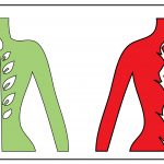 CBD for MS Pain