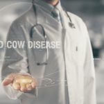 Human Mad Cow Disease