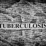 Tuberculosis Symptoms