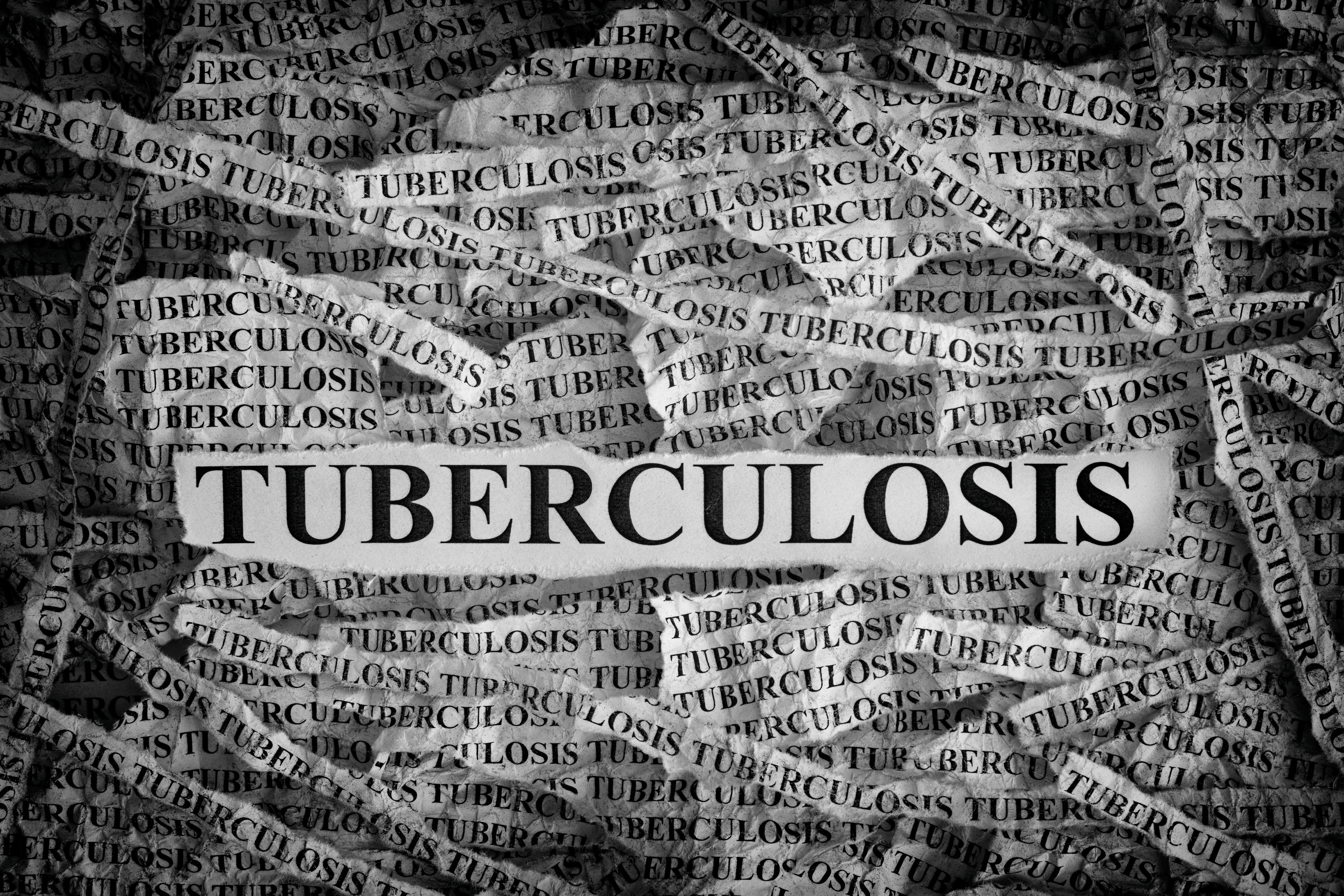 Tuberculosis Symptoms - Cannabidiol 360