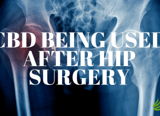 Benefits of Using CBD Following Hip Replacement Surgery