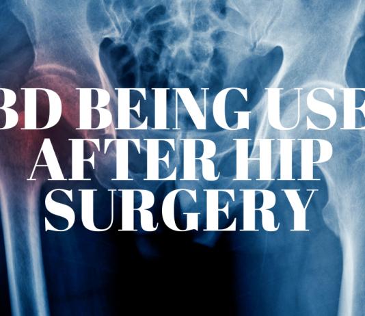 Benefits of Using CBD Following Hip Replacement Surgery